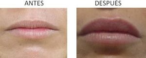 Perfil de los labios