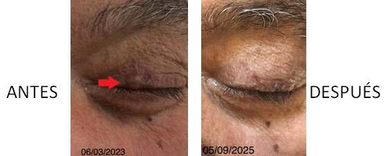 photo_5915490849880394139_x